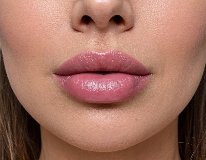 Lip fillers Glasgow